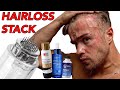 My New Hair Loss Protocol  (Micro Needling)