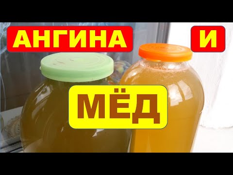 Ангина и МЁД.  Тонзиллит. Лечение горла.