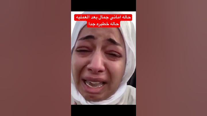 حالة اليوتيوبر اماني جمال بعد العملية واخر تطورات حالتها الصحيه