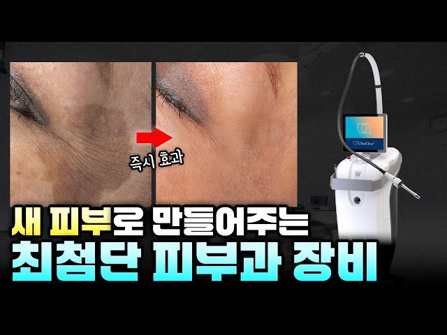 일주일이면 피부가 새로 태어납니다