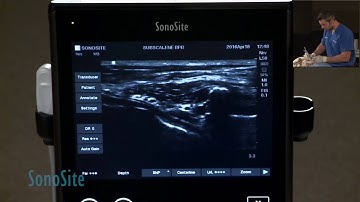 Ultrasound Guided Brachial Plexus Nerve Block in a Dog: Part 3 of 3