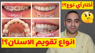 انواع تقويم الاسنان بالصور واسعارها | ازاي تختار النوع المناسب؟! | التقويم المعدني والشفاف والمتحرك