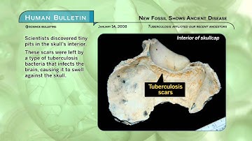 Science Bulletins: New Fossil Show Ancient Disease