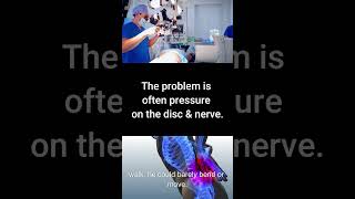 Avoiding Back Surgery? |Real Sciatica & Herniated Disc Recovery Story | DRX9000 Spinal Decompression