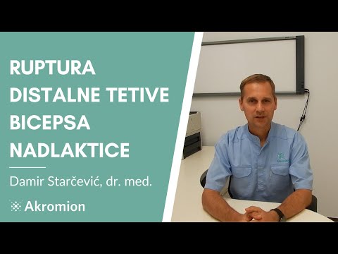 Ruptura distalne tetive bicepsa nadlaktice - Damir Starčević, dr.med. -Specijalna bolnica Akromion