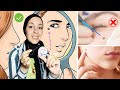 بهذه الطريقة تخلصت من الزوائد الجلدية والشامات بدون جراحة   