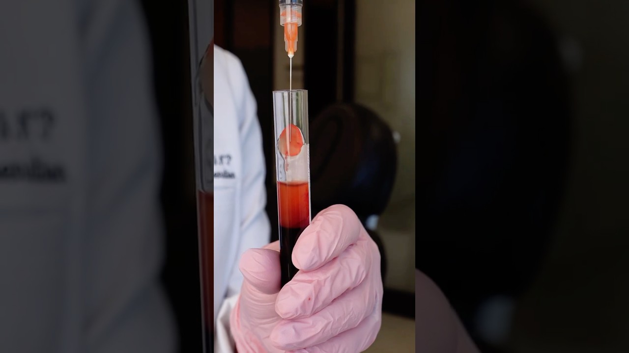 PRF Mistakes That Ruin Your Results (Watch Before You Inject!)