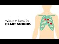 Where to listen for Heart Sounds (Auscultory Areas) - MEDZCOOL