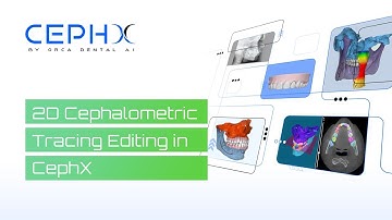 2D Cephalometric Tracing Editing in CephX