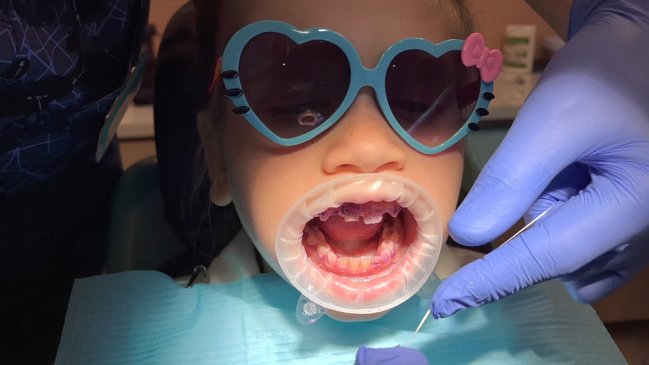 GBT протокол у детей.