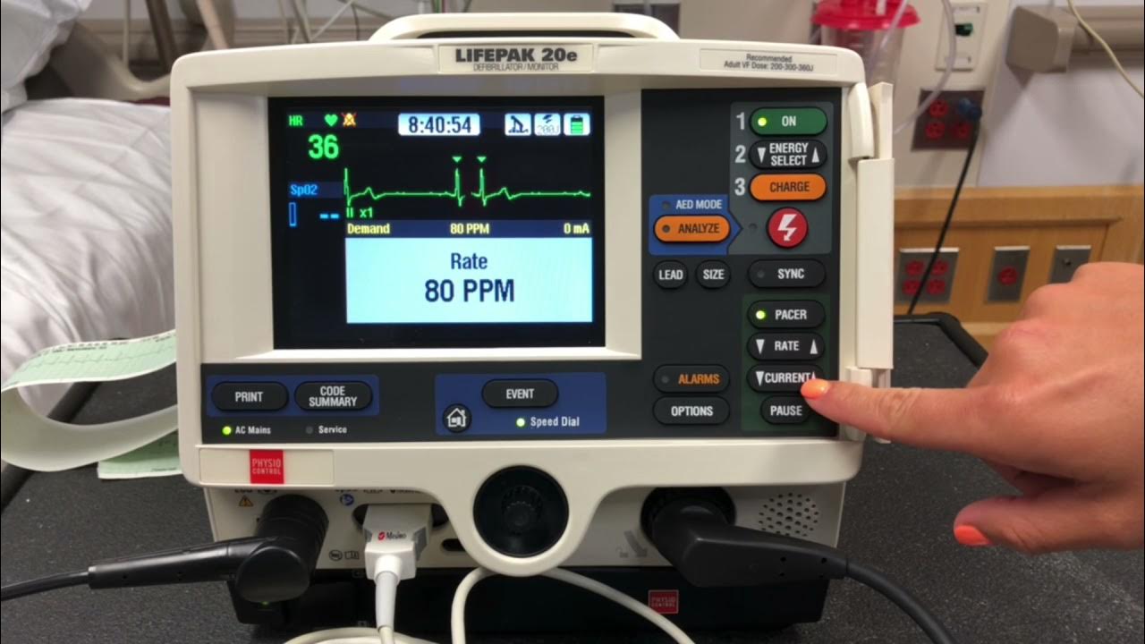 LifePak 20e Transcutaneous Pacing YouTube