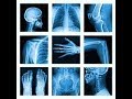 محاضرة : عوامل السلامة في تصوير الانسان بالأشعة السينية ( X ray ) : التصوير الطبي Medical X-ray Imaging