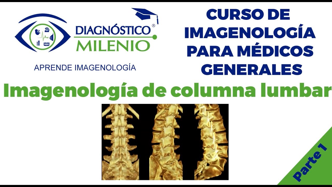 Imagenología de columna lumbar  Parte 1