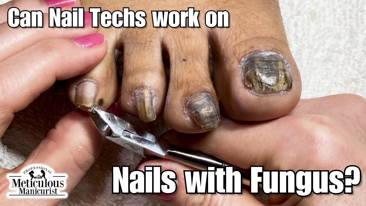 310+ Ugly Nails Stock Videos and Royalty-Free Footage - iStock | Bad nails,  Nail polish, Hair