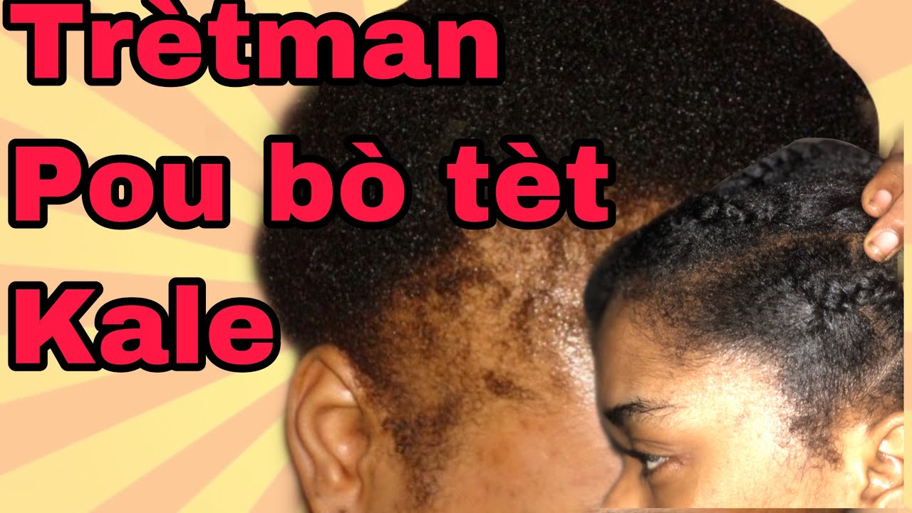 Pouse bò tèt ou san rete ak trètman sa💯 #haitiancreator