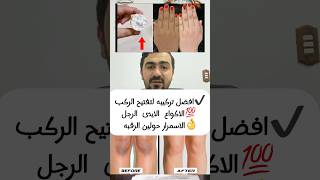 تركيبه_لتفتيح الركب والاكواع foryou trend doctor