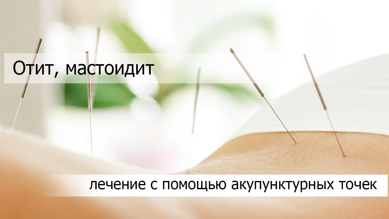 Отит, мастоидит - YouTube