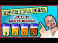 ¿Qué SIGNIFICA el COLOR de tu ORINA? || ¿Cuál INDICA enfermedad GRAVE?