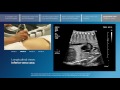 Advanced screening views of the fetal heart - Part 6 - Longitudinal views