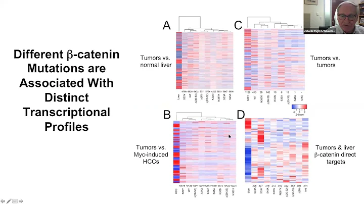 Drivers of Pediatric Liver Cancer and its Biological Diversity, Edward V  Prochownik, July 30 2021