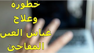 أسباب غباش العين المفاجئ | تعرف عليها | معلومات هامه جدا