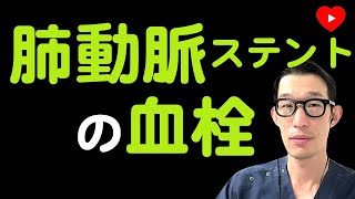 【ストラクチャ】経カテーテル肺動脈弁置換術後の弁血栓付着