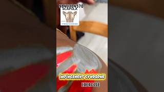Shoulder Impingement Syndrome,