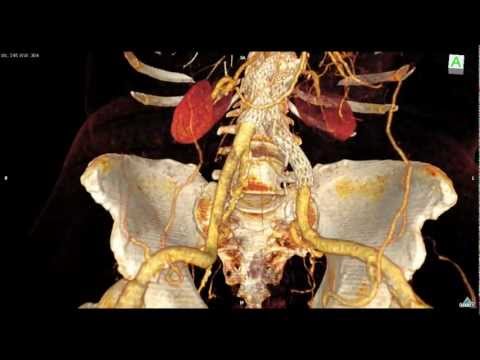 Endoscopy Dan Ct Scan