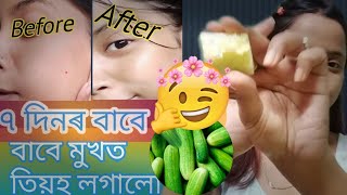 তিয়হ এনেদৰে লগাই পাইছে নে? applied cucumber on my skin for 7days for glowing skin