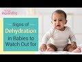 Signs and Symptoms of Dehydration in  Babies that Parents Must Know About