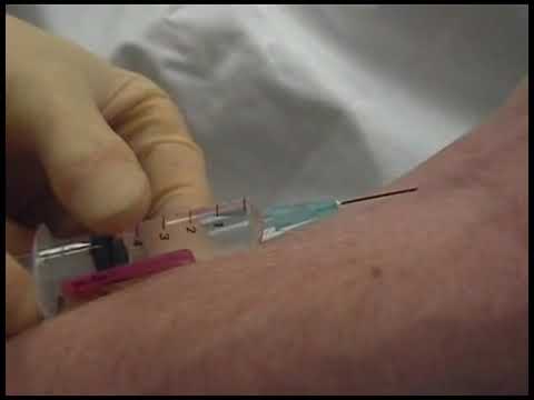 Внутривенная инъекция.