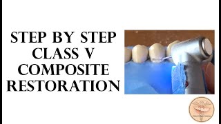 STEP BY STEP - Class V dental restoration with composite