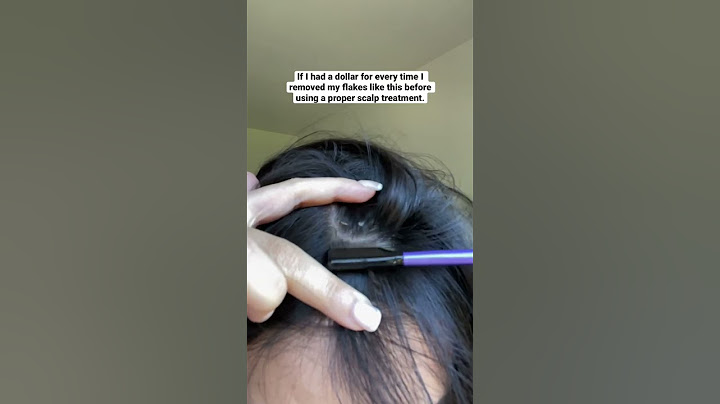 Seborrheic Dermatitis | Act+Acre