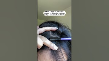 Seborrheic Dermatitis | Act+Acre