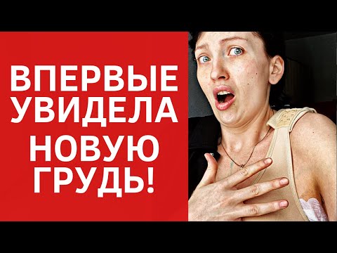 Видео: Анастасия за резултатите от пластичната хирургия