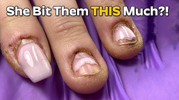 I Let an AI E-File Fix These Bitten Nails — The Results Are Unreal