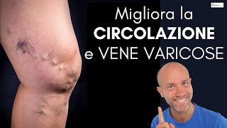 VARICI, cattiva circolazione VENE VARICOSE   consigli pratici