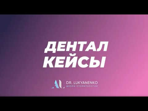 Тотальная реконструкция 28 керамических реставраций - ДенталКейсы