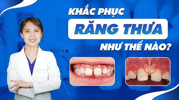 Khắc Phục Răng Thưa Như Thế Nào? | Nam Bùi Vinalign