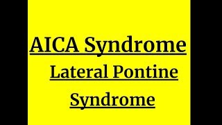 AICA Syndrome/ Lateral pontine syndrome Resimi