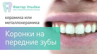 Коронки на передние зубы - какие поставить?