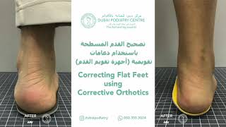 Before & After Custom Orthotics | Fix Foot Pain, Flat Feet & Improve Posture