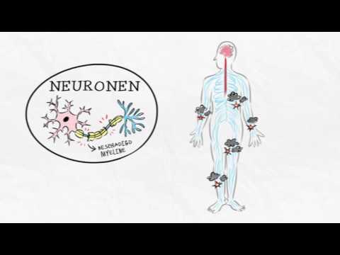 Video: 3 manieren om chronische inflammatoire demyeliniserende polyneuropathie (CIDP) te behandelen