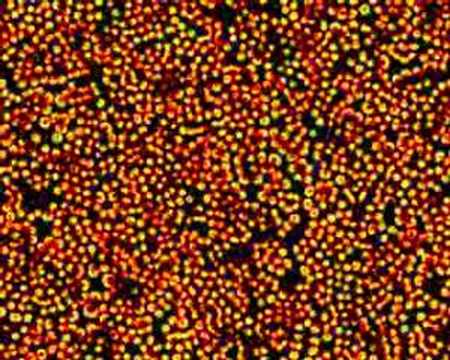 Reaction diffusion waves