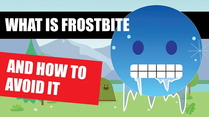 FROSTBITE Symptoms And Signs And How To Avoid Them [Survival Tips And Tricks]