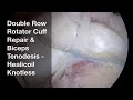 Healicoil Knotless - Double-Row Rotator Cuff Repair &amp; Biceps Tenodesis