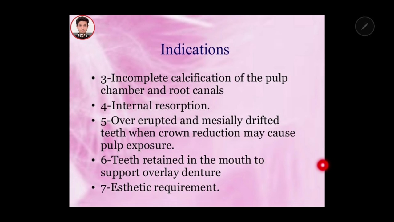 indication of endodontic treatment'' RCT'' دواعي عمل علاج جذور للأسنان