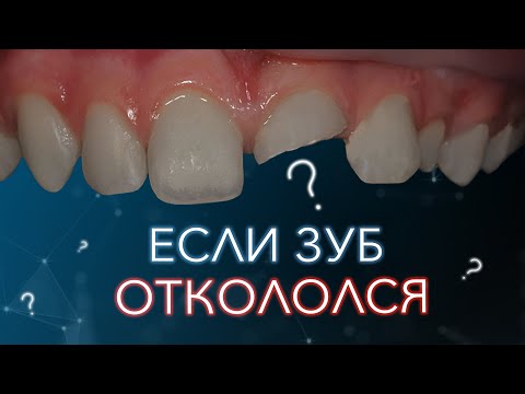 Откололся зуб. Что с этим делать?