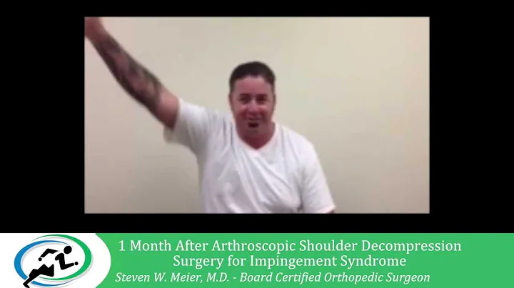 Recovery from Arthroscopic Shoulder Decompression ...