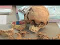 Des centaines de squelettes découverts à Amiens lors de fouilles archéologiques